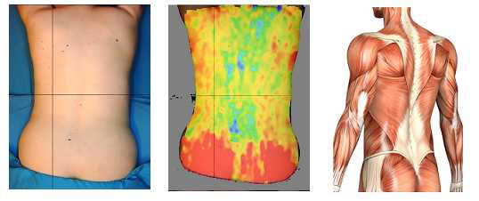 Typical Back Scan